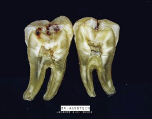 tooth in Arabic